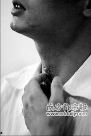 男人颈部照片